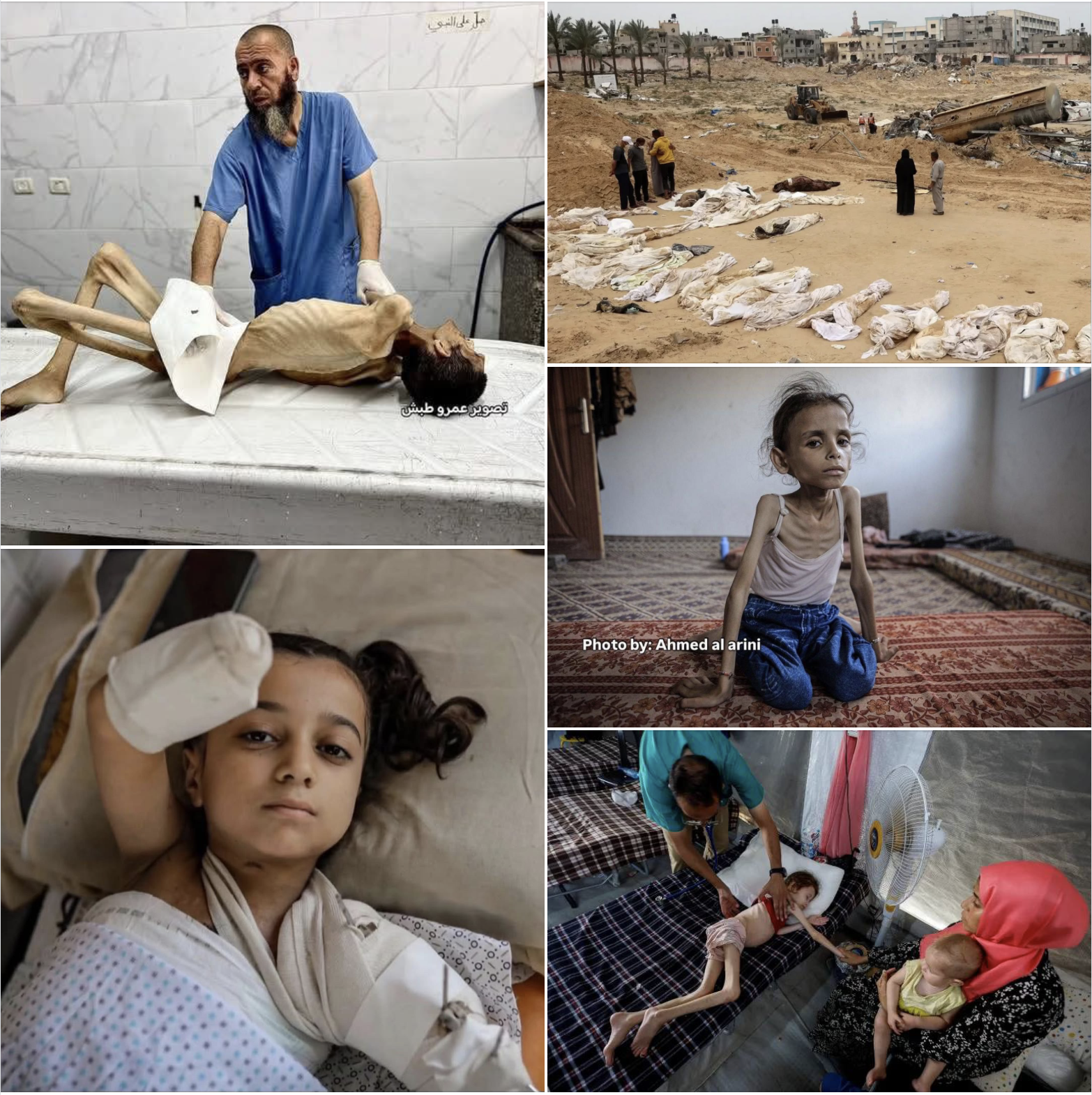 You are currently viewing Only Psychopaths Could Still Support Israel, and the US-Israeli Genocide in Gaza